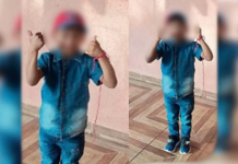 Menino de 8 anos é picado por escorpião e está em coma em Itaquiraí