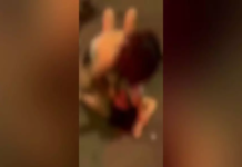 Mãe apanha da atual do ex na frente da filha durante atendimento à criança com médico